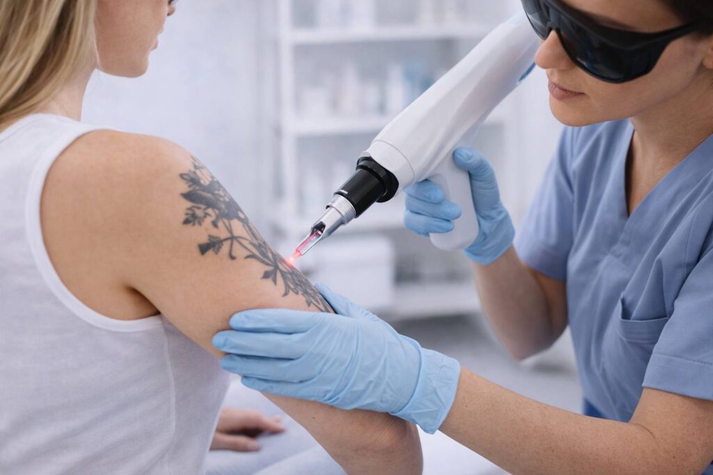 Remoción de tatuajes con fisioterapia dermatofuncional